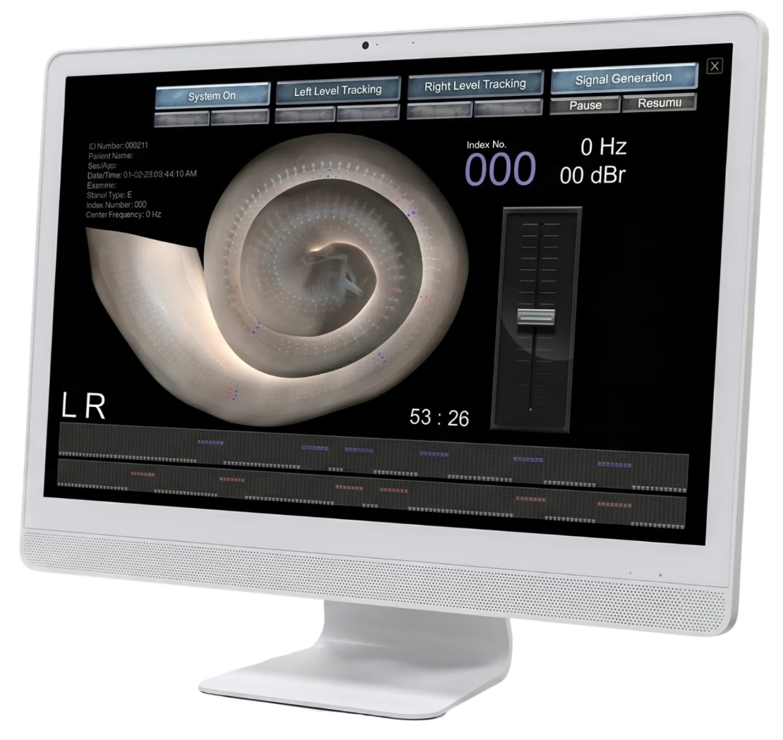 REVE134 software interface showing cochlear visualization on a monitor
